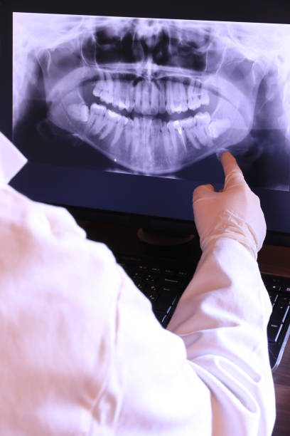 Best Emergency Tooth Extraction in Big Spring, TX